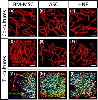 Bone Marrow Derived Mesenchymal Stromal Cells Promote Vascularization and Ciliation in Airway Mucosa Tri-Culture Models in Vitro